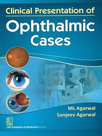 Clinical Presentation Of Opthalmic Cases (Pb2014) 